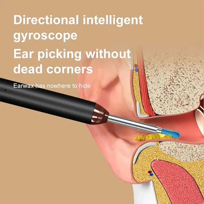 Cleavia™ Smart Ear Cleaner with HD Camera – Wireless Otoscope for Safe & Easy Care